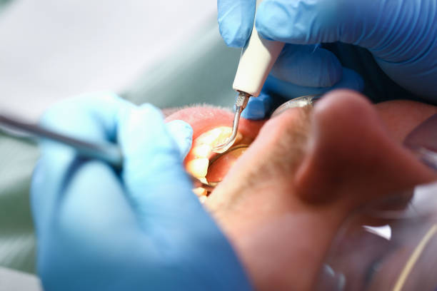 Best Broken or Cracked Tooth Emergency Dentist in Maud, TX