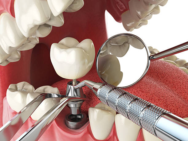 Best Mobile Emergency Dentist in Maud, TX